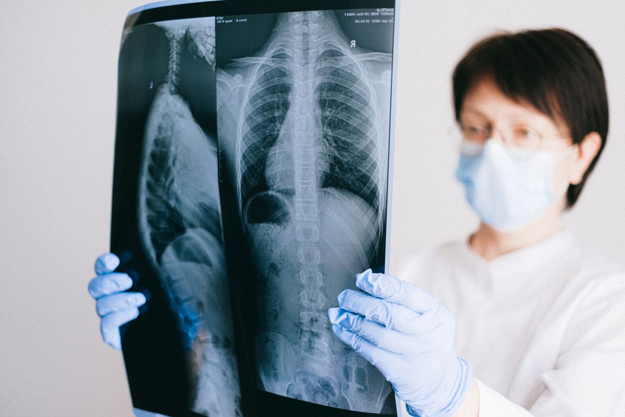 Unstable Spinal Fractures During International Medical Repatriation